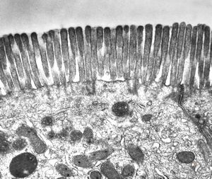normal jejunal enterocyte normal jejunal enterocyte